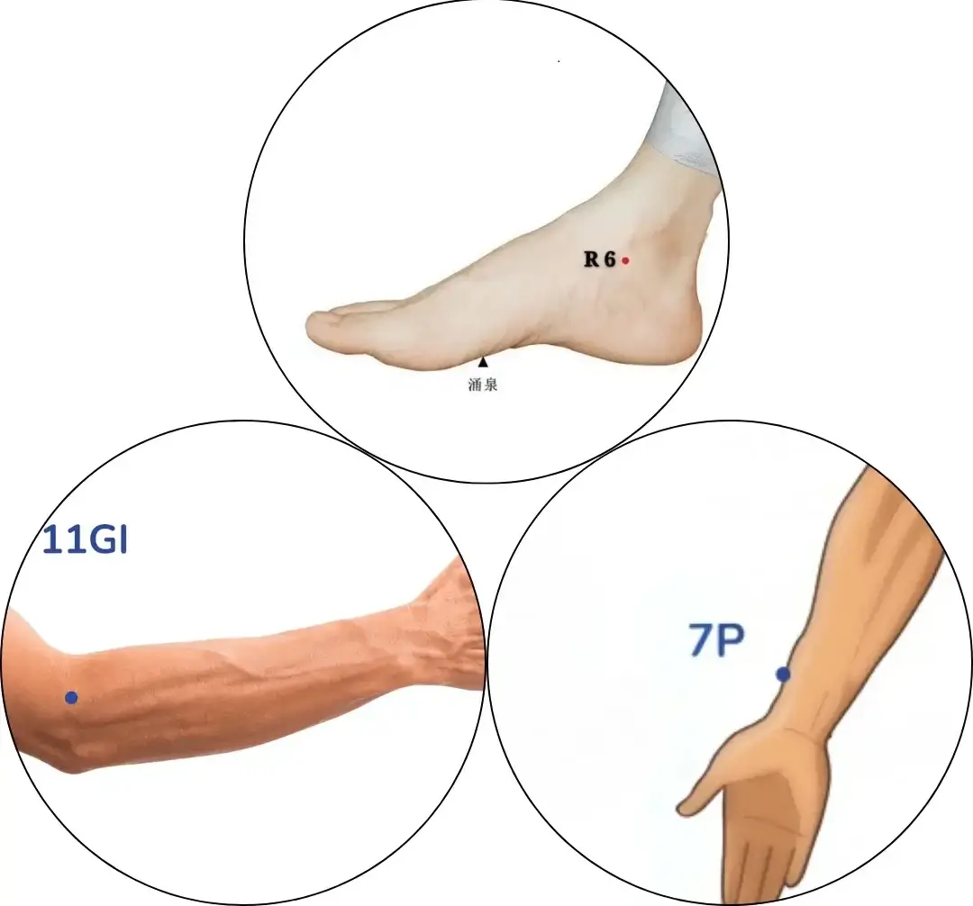 Les points R6, P7 et GI11 d'automassage Les points R6, P7 et GI11 d'automassage