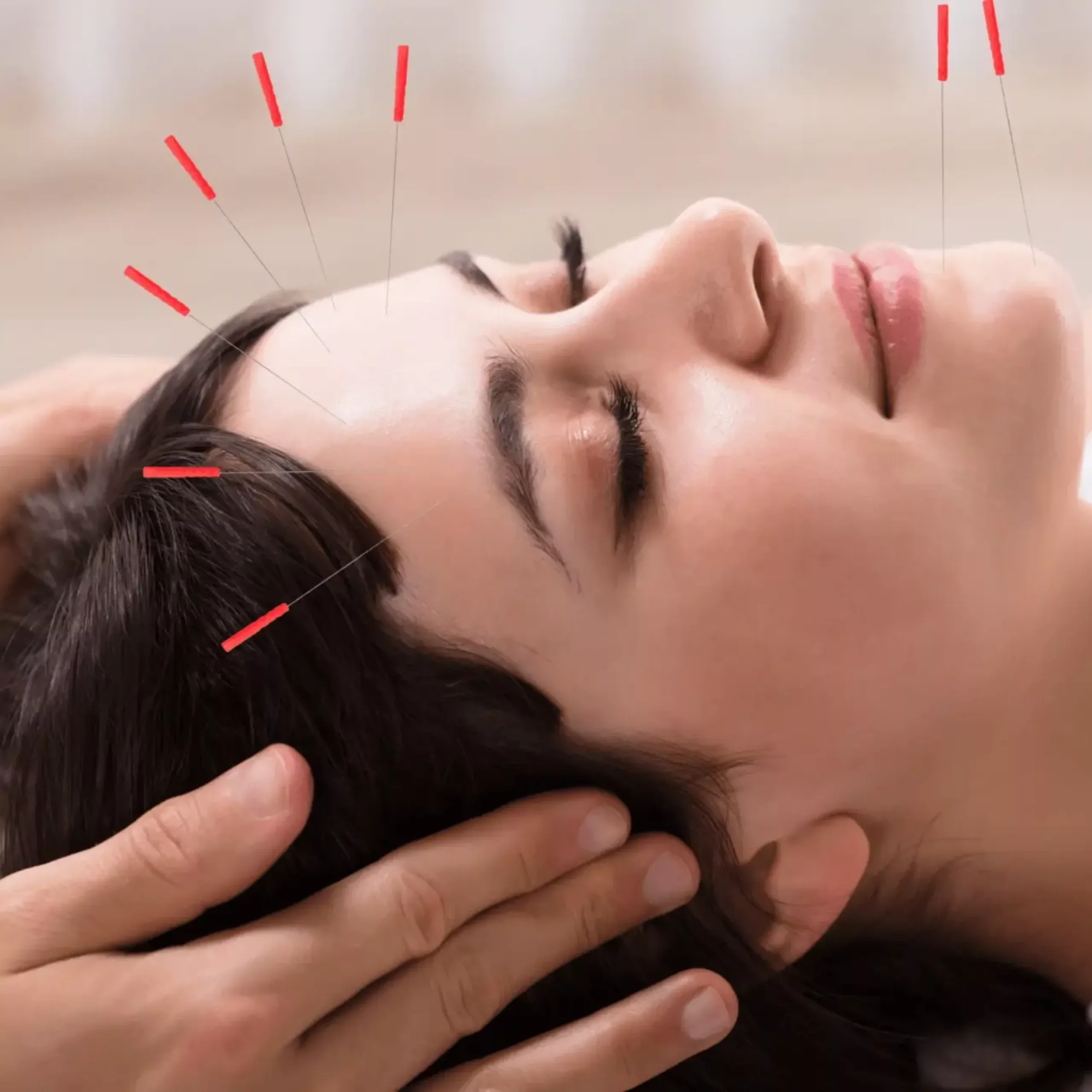 Prestations Acupuncture BioMed MTC